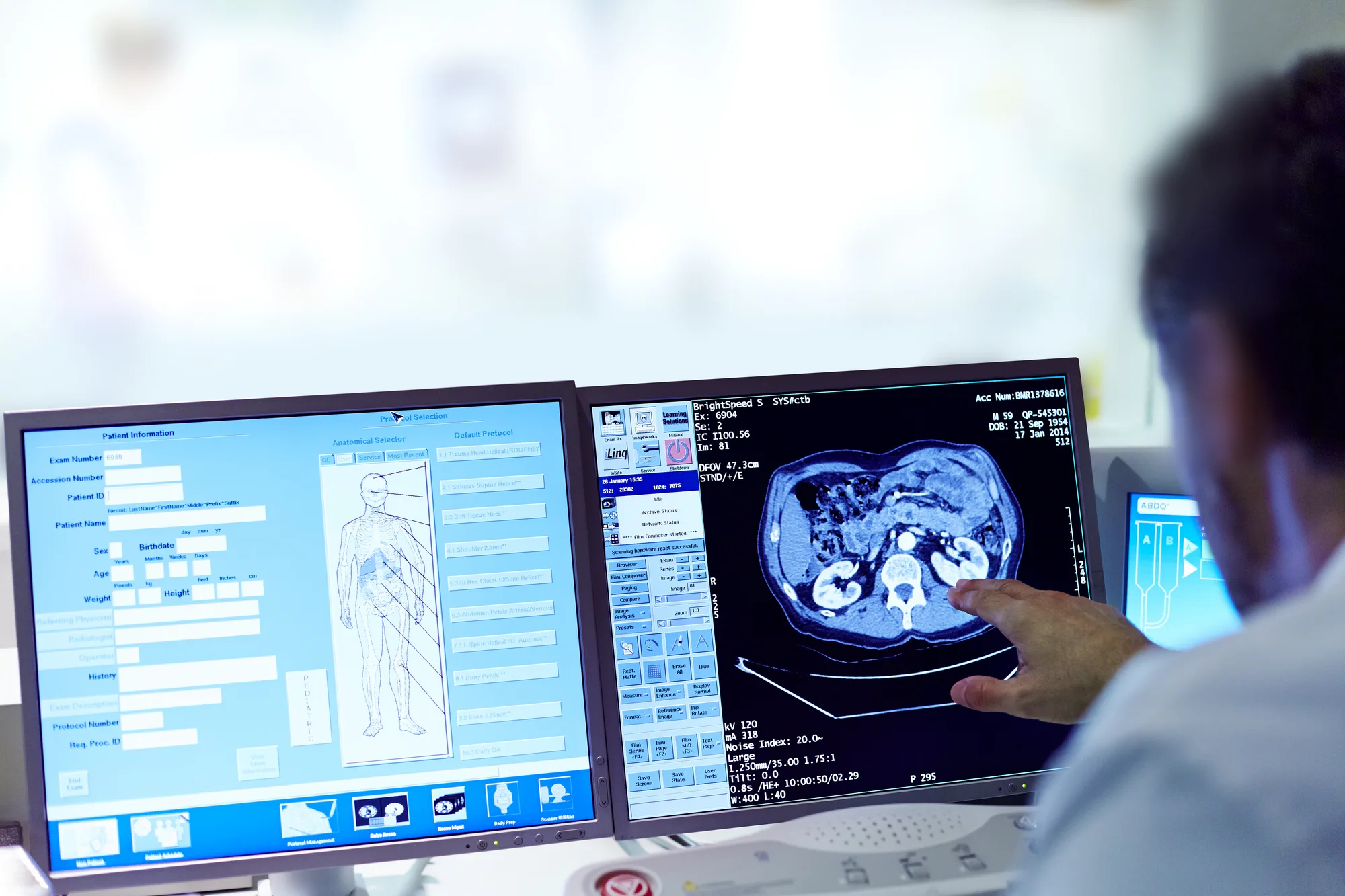 Cover image for “Should Employees Start Colon Screening at Age 45?”