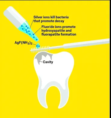 Cover image for “Great news! I got a cavity.”